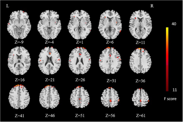 FIGURE 3