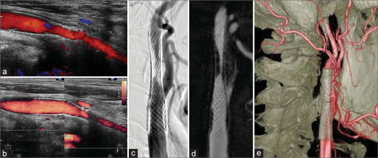 Figure 3: