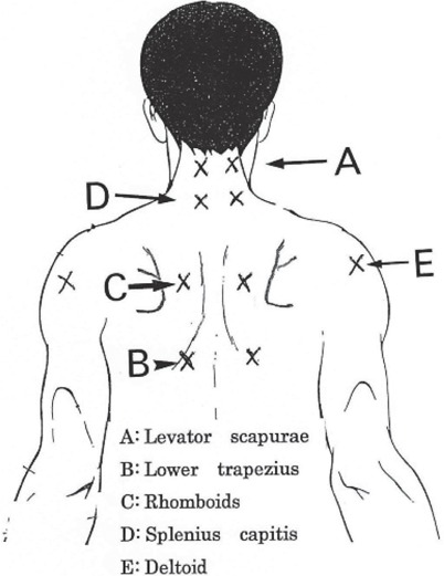 Fig. 2: