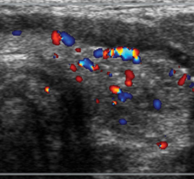 Figure 4b: