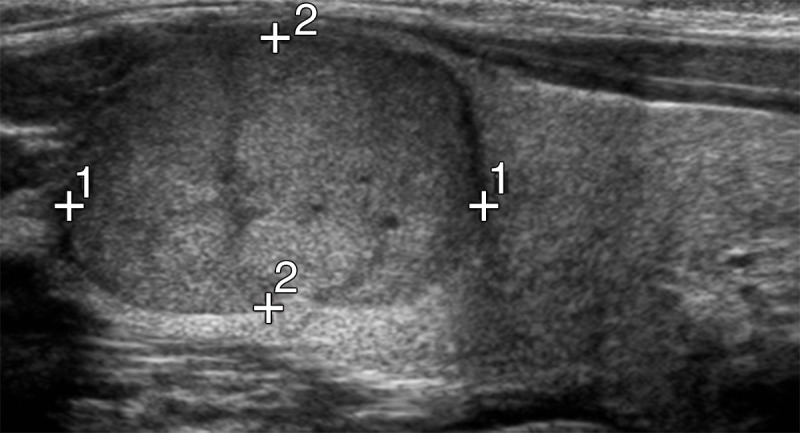 Figure 2a: