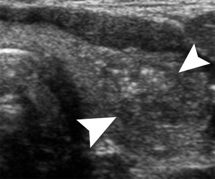 Figure 4a: