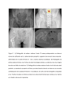 Figura 2