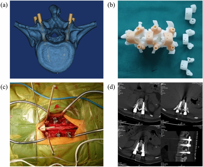 Figure 10