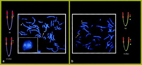 Figure  4