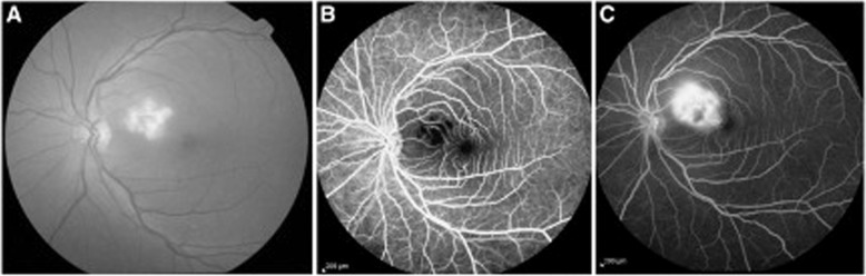 Fig. 6