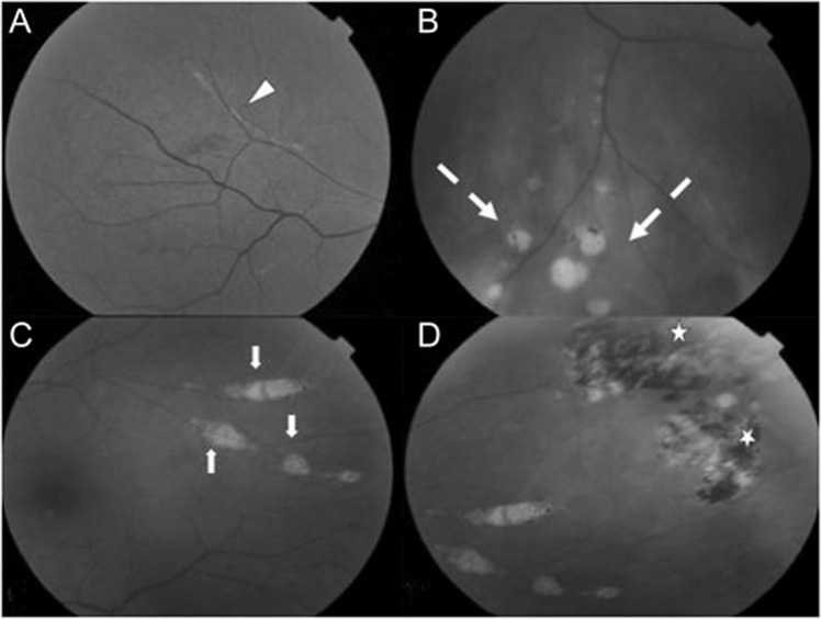 Fig. 4