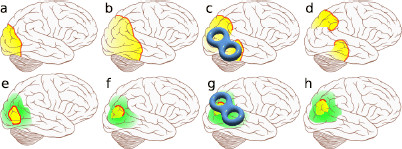 
Fig. 12
