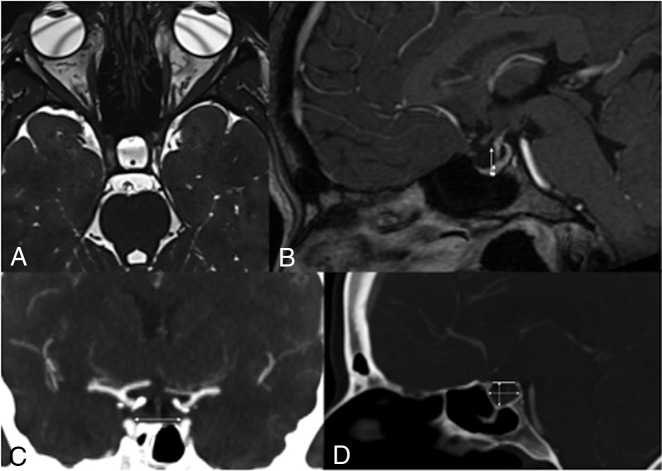 Fig 1.