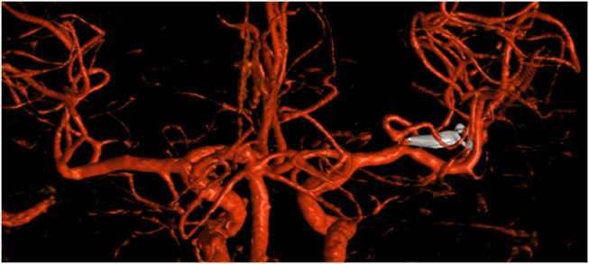 Fig 2