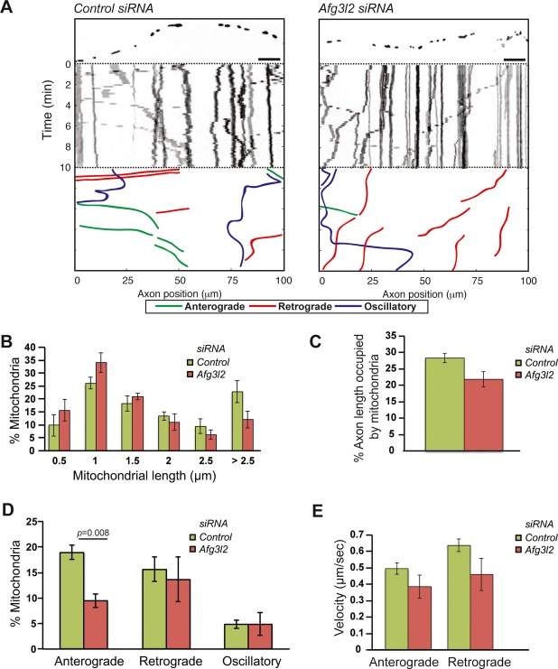 Loss of the m-AAA protease subunit AFG3L2 causes mitochondrial ...