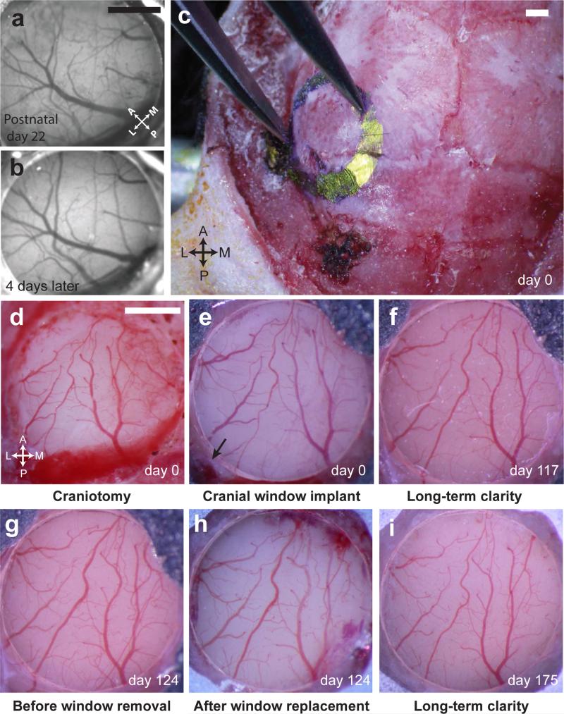 Long-term imaging in awake mice using removable cranial windows - PMC