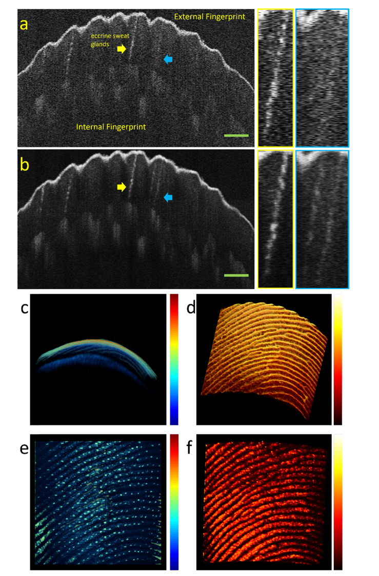 Fig. 16