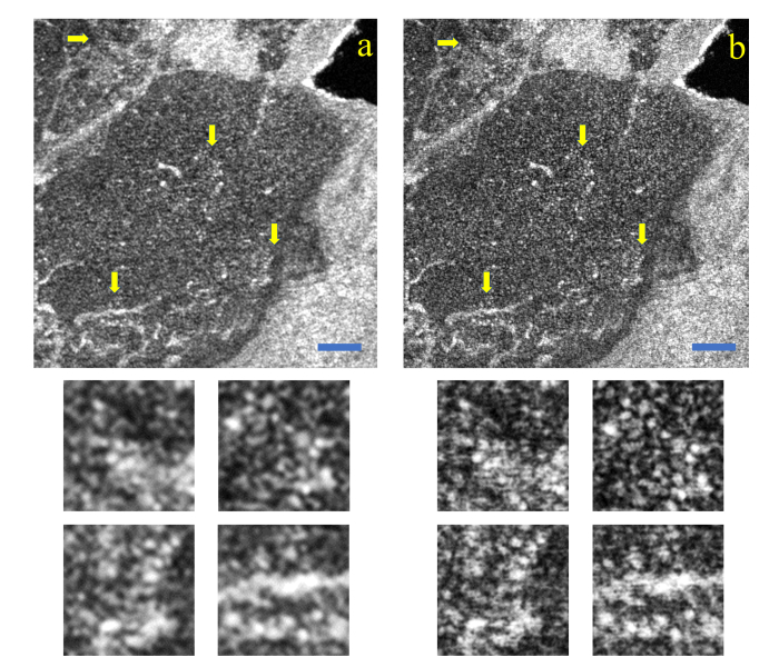 Fig. 14