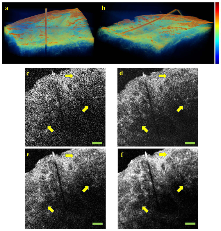 Fig. 13