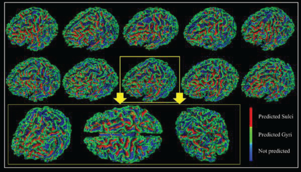 Fig 3.