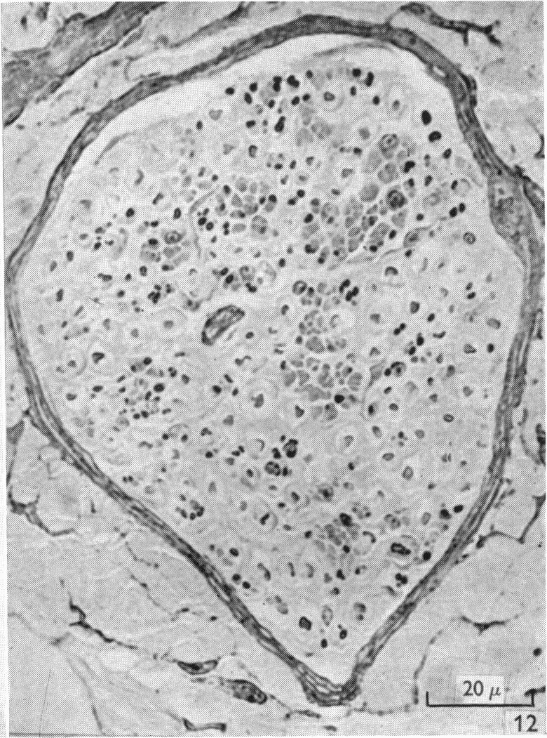 Fig. 12