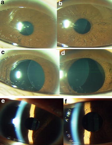 Fig. 4