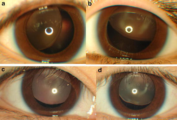 Fig. 2