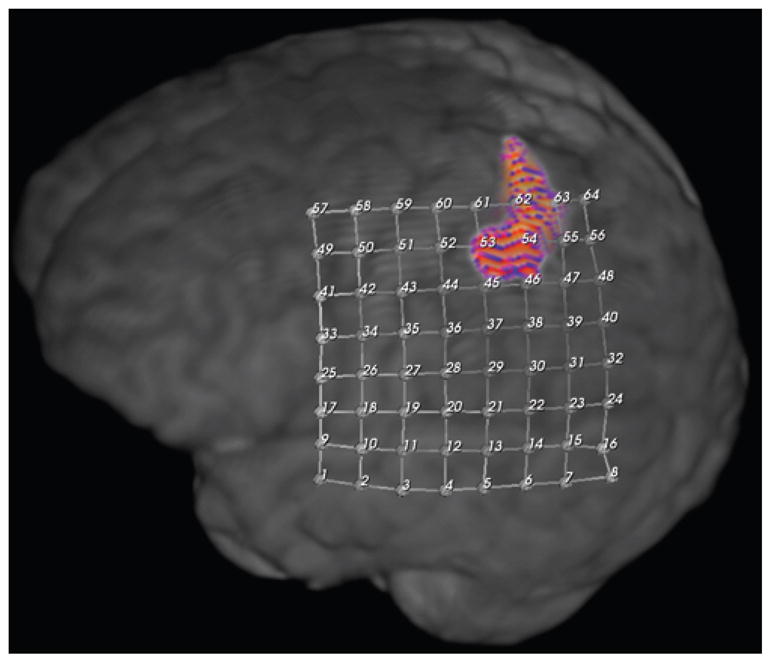 Fig. 3