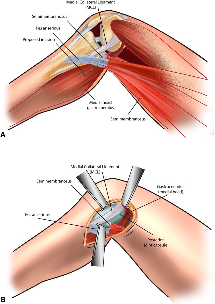 Fig. 2A–C