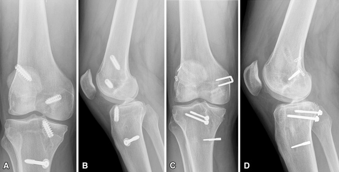 Fig. 5A–D