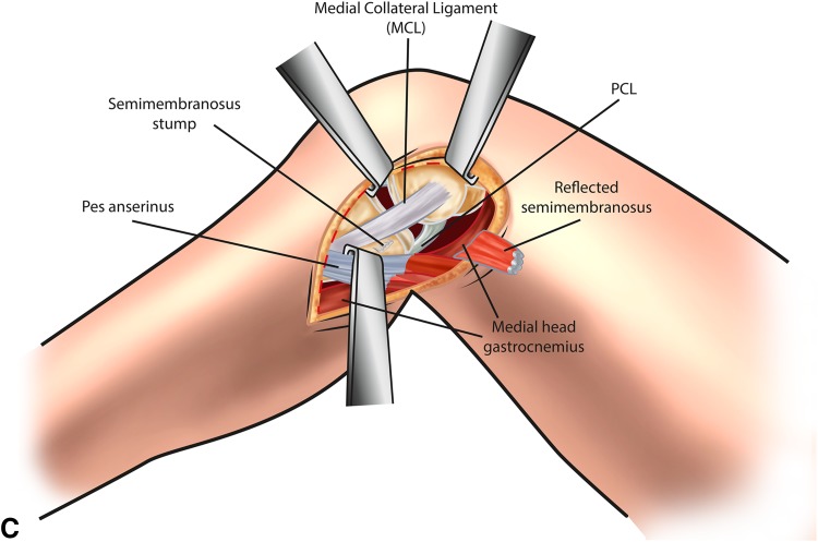 Fig. 2A–C