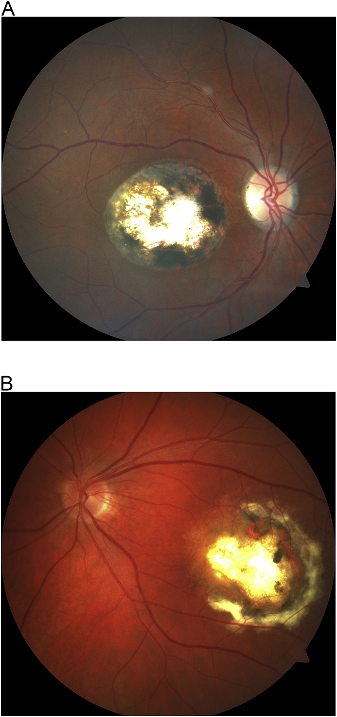 Fig. 2