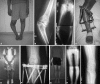 Fig. 1A–I