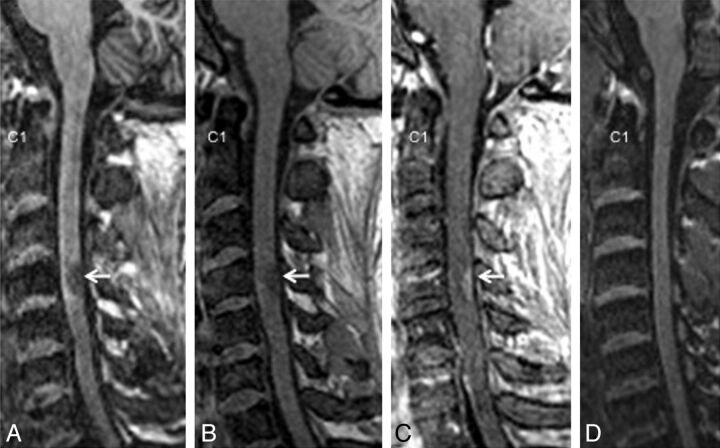 Fig 3.