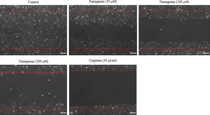 FIGURE 3