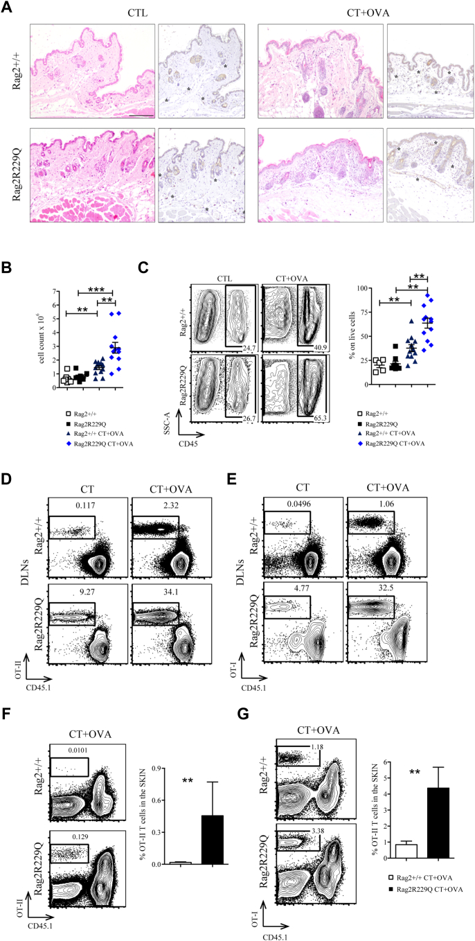 Fig E4