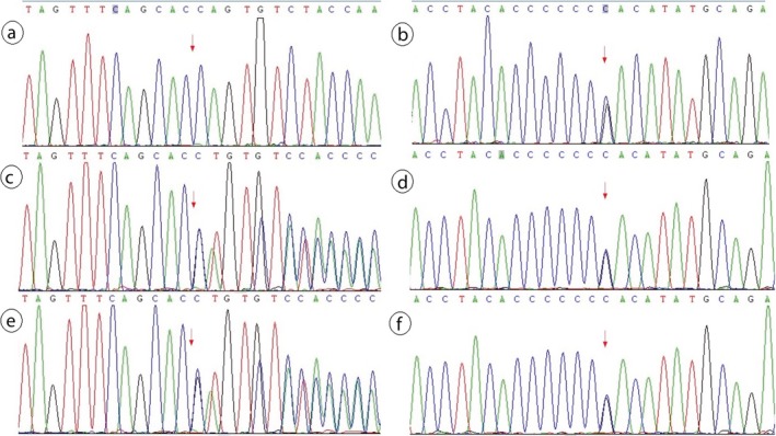 Figure 14