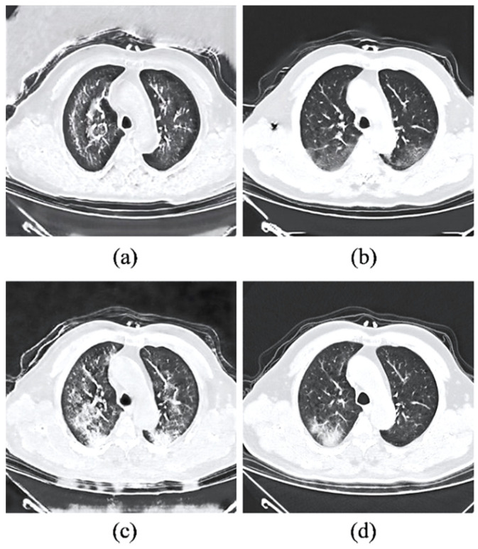 Figure 15