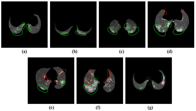 Figure 13