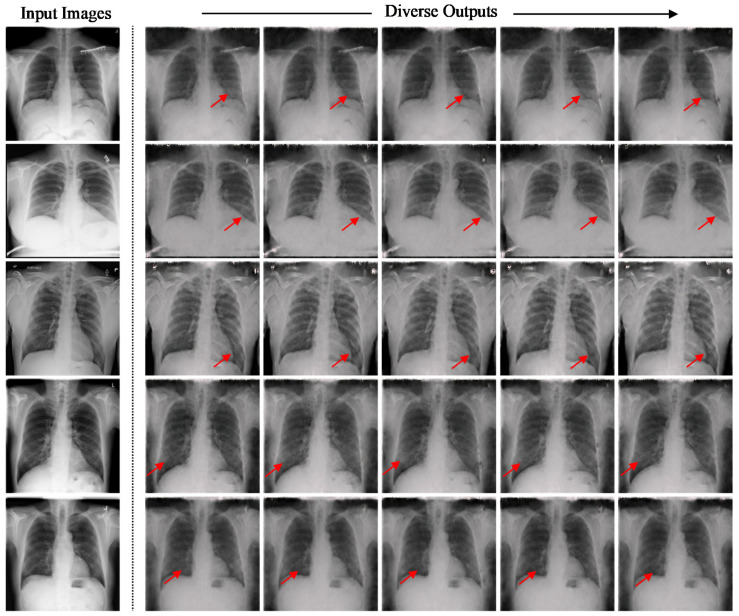 Figure 21