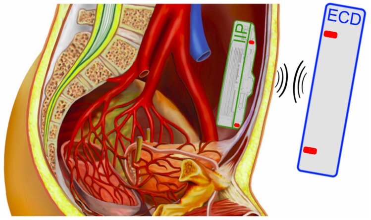 Figure 10