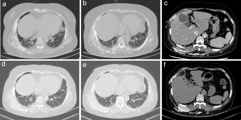 Fig.2