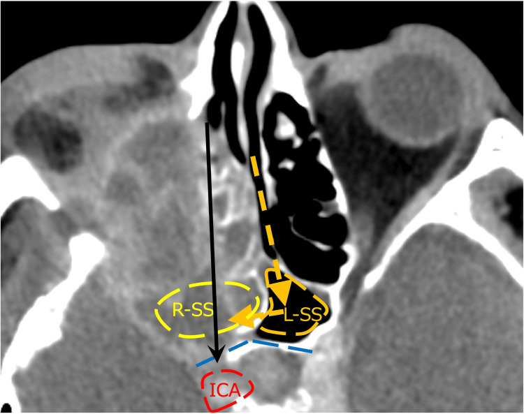 Figure 10