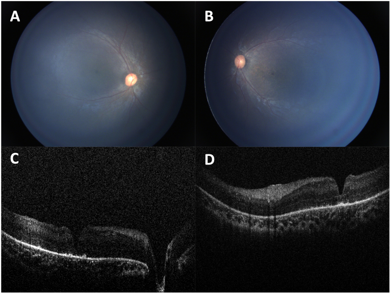 Fig. 4