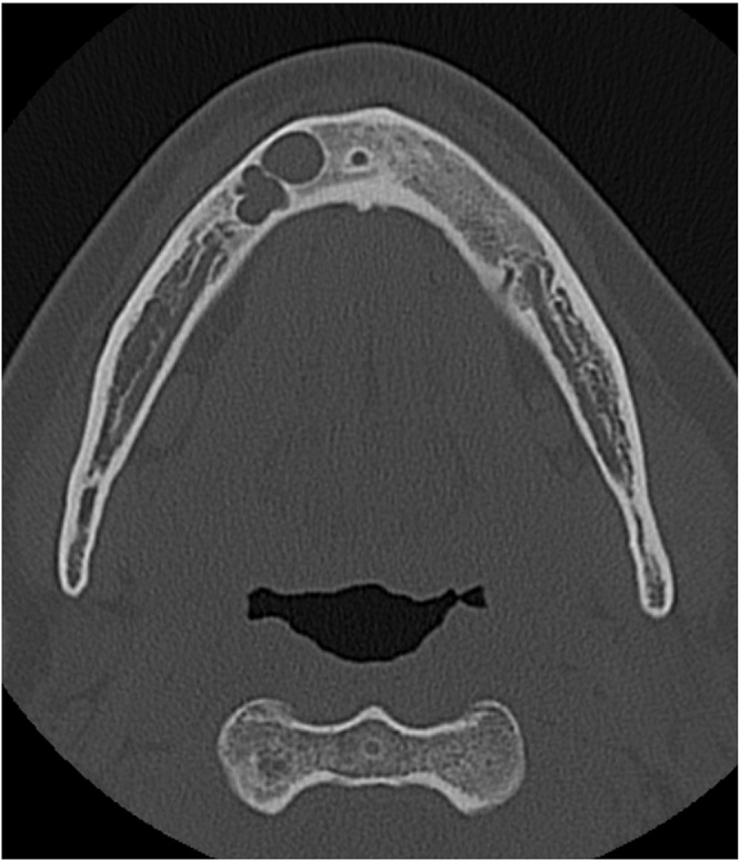 Fig. 4
