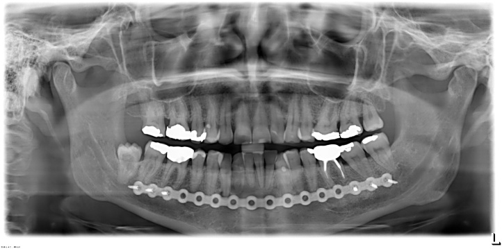 Fig. 5