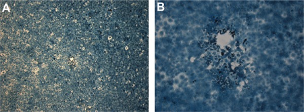 Microplaques formed in Vero-E6 cell infected by Rio Mamoré virus with
addition of dimethyl sulfoxide 0.6% in medium-viscosity overlay medium. Shown
in 40X (A) and 1,000X (B).