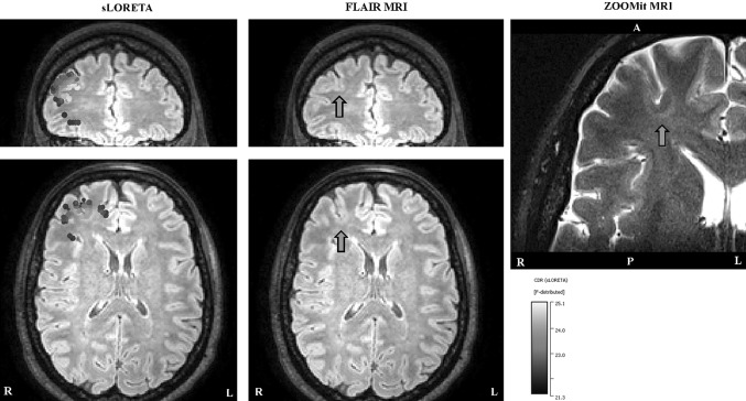 Fig. 6