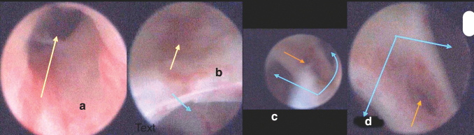 FIG. 1.