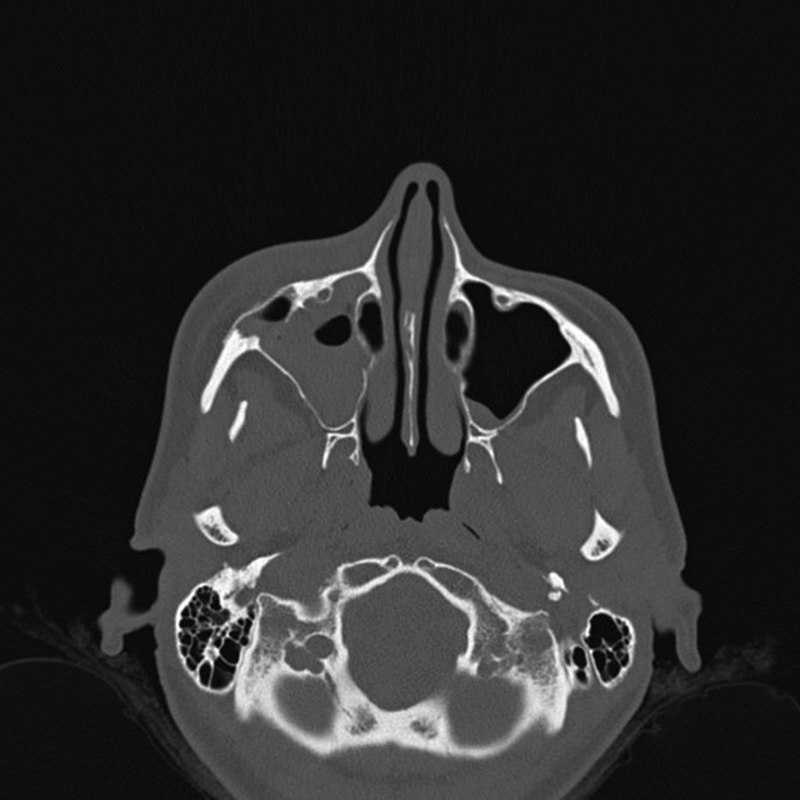 Fig. 5