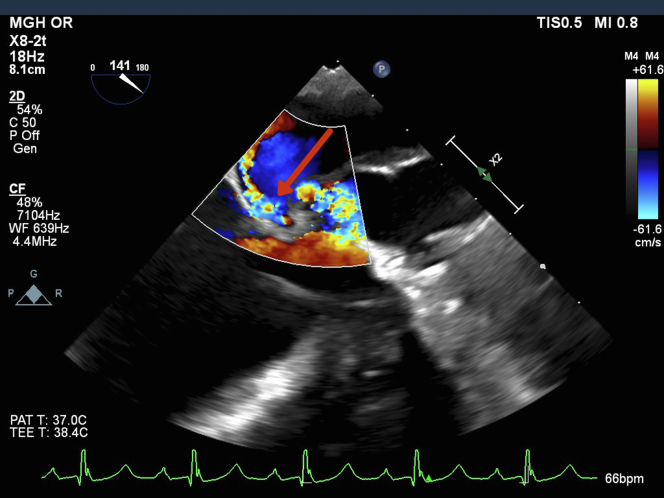 Figure 6