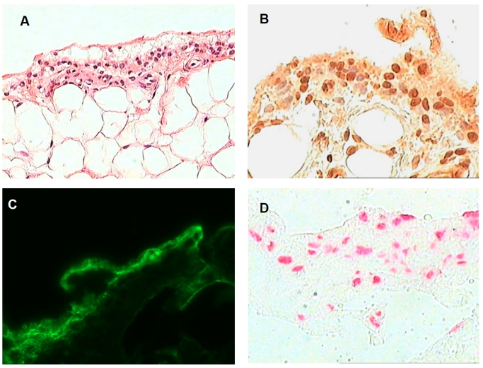 Fig. (1)