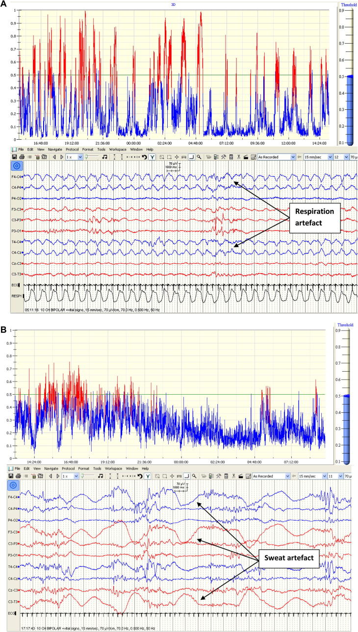 Fig. 4