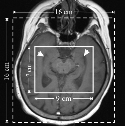 Figure 1b: